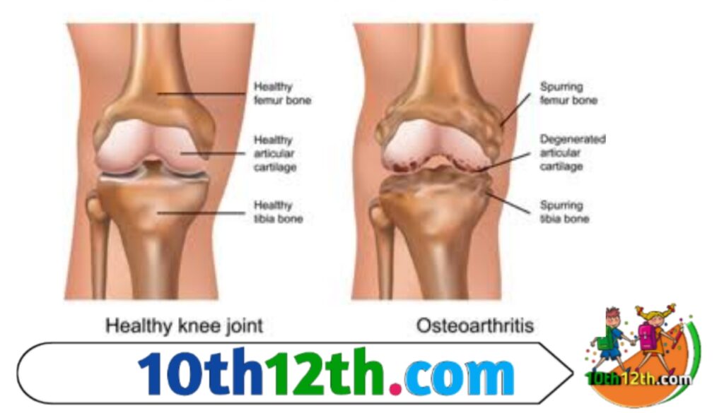 ओस्टियोब्लास्ट हड्डी बनाते हैं और चोंड्रोसाइट्स उपास्थि बनाते हैं। इसलिए जब तक आपके पास कोशिकाएं ऑस्टियोब्लास्ट में विभेदित हो जाती हैं, तब तक उनके लिए कार्टिलेज बनाना शुरू करने में बहुत देर हो चुकी होती है।